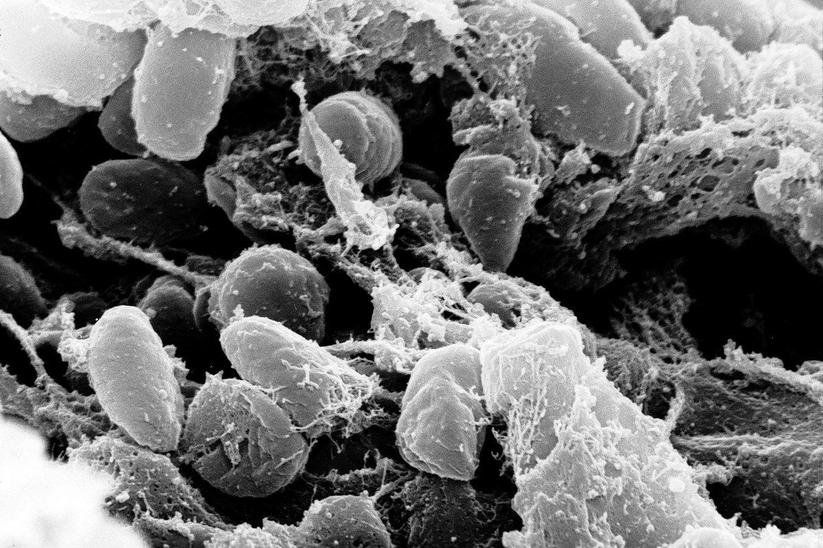Scanning electron micrograph of a dense mass of rod-shaped Yersinia pestis bacteria, the microbe that causes plague, shown in false colour